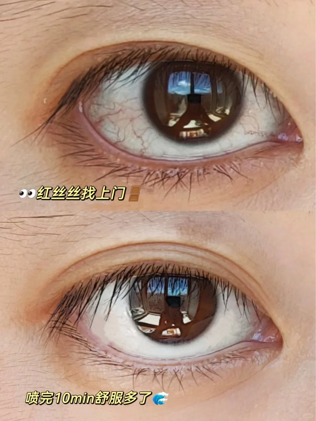 护眼别摆烂！1分钟自测度数！