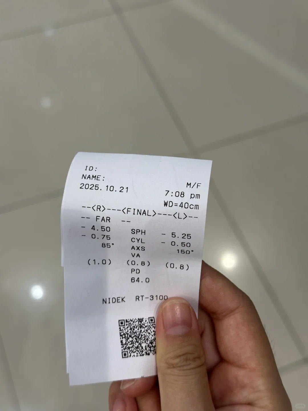 我天！隔4天眼睛度数差了50度！！