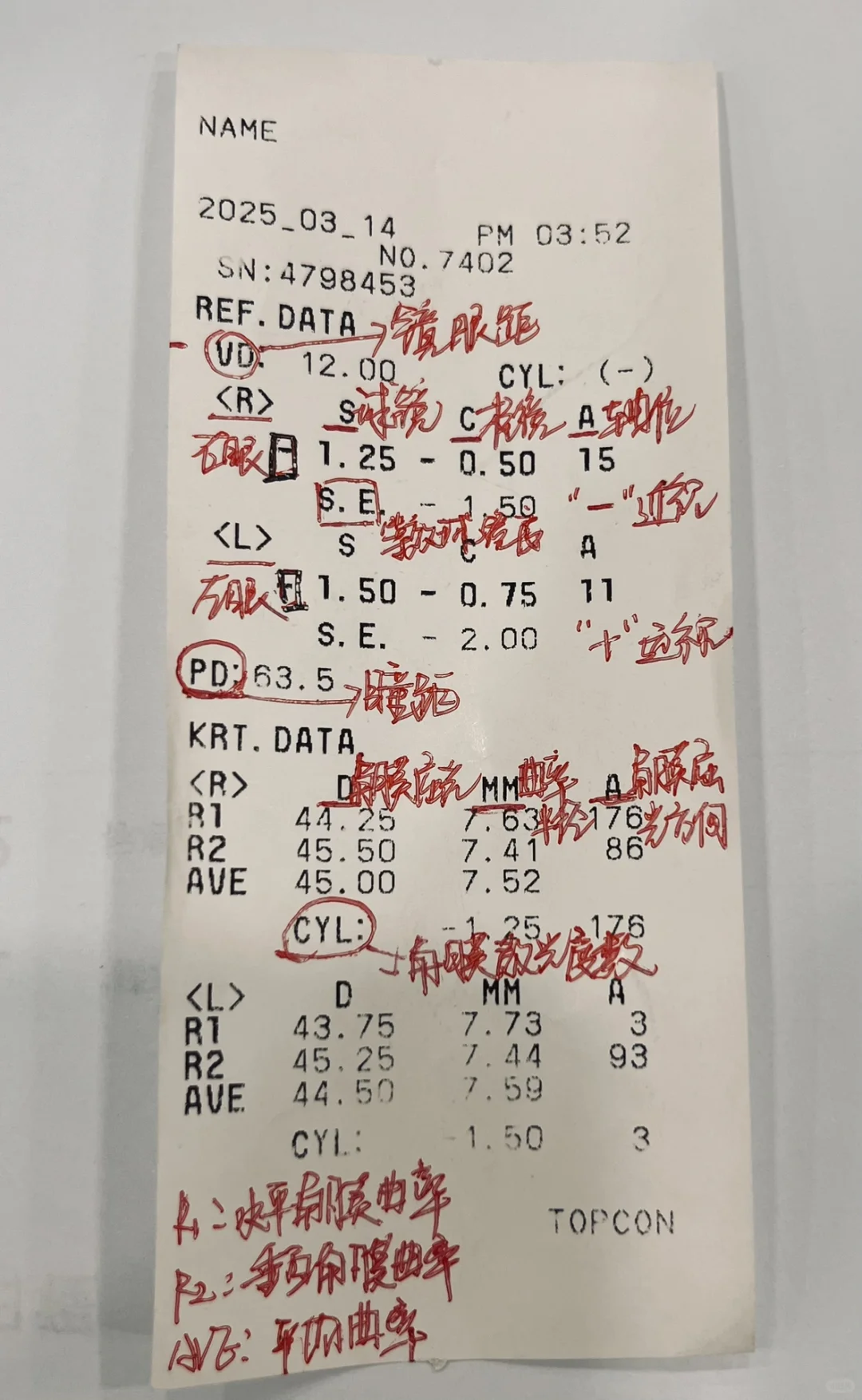 还不知道自己近视散光多少度吗？