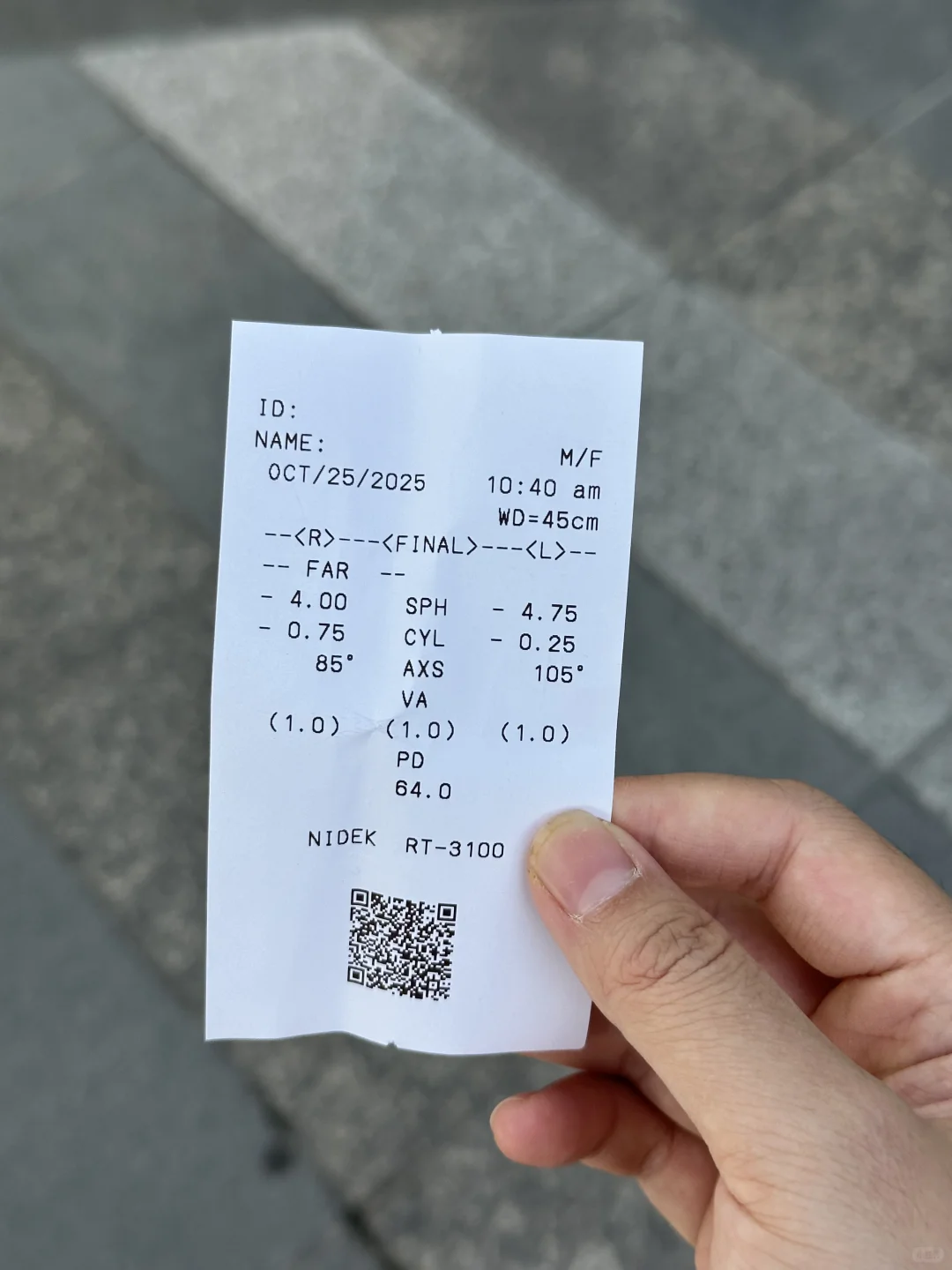 我天！隔4天眼睛度数差了50度！！