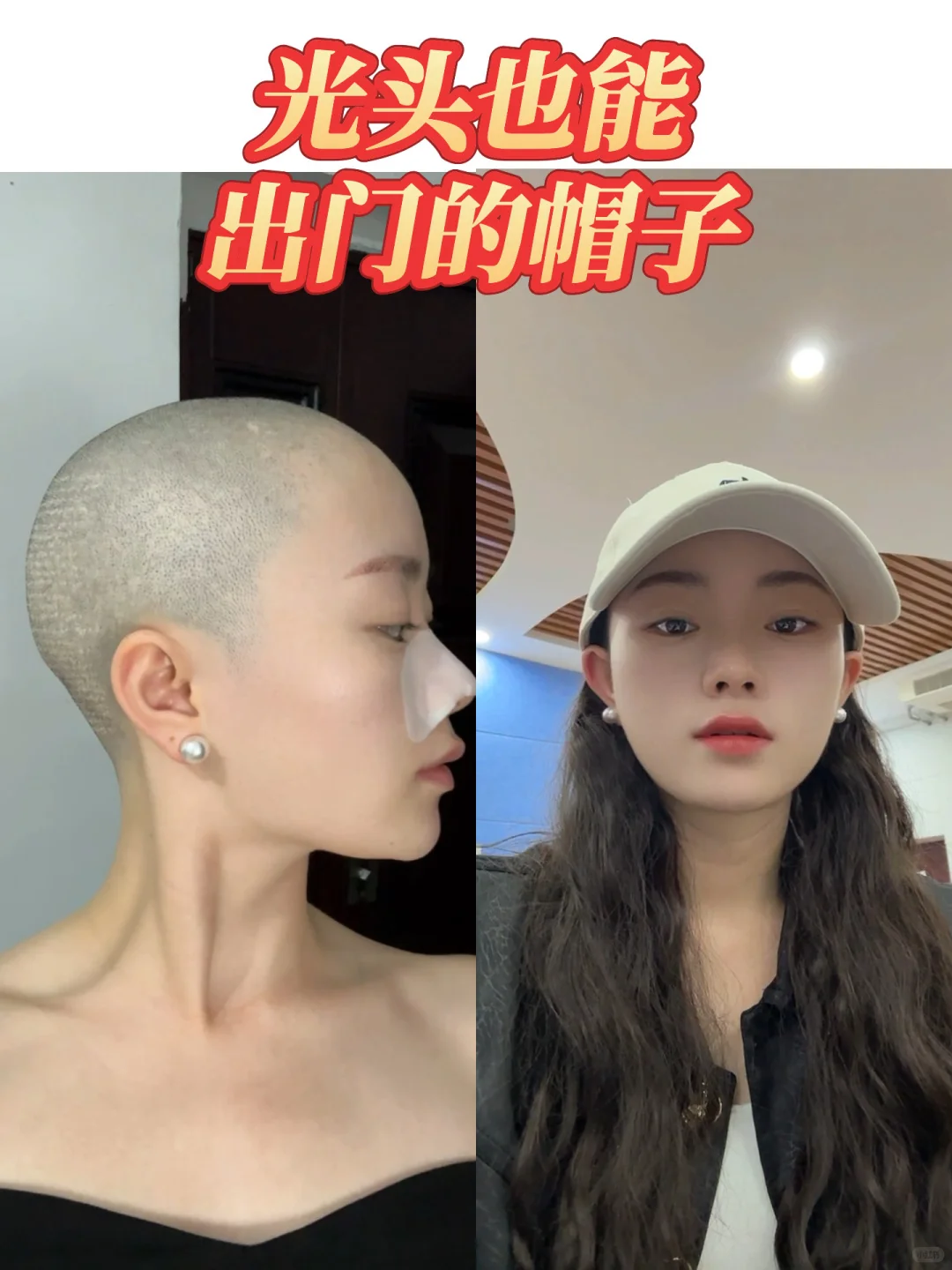 光头的话上课戴假发帽就好了