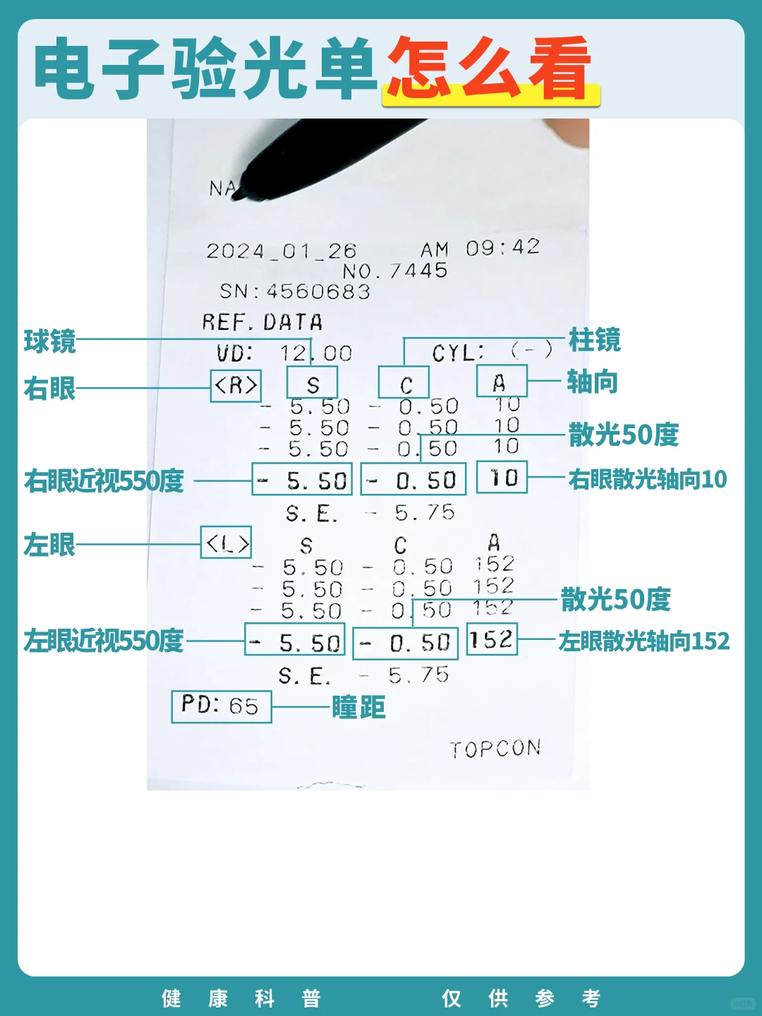 眼科检查，验光单怎么看？