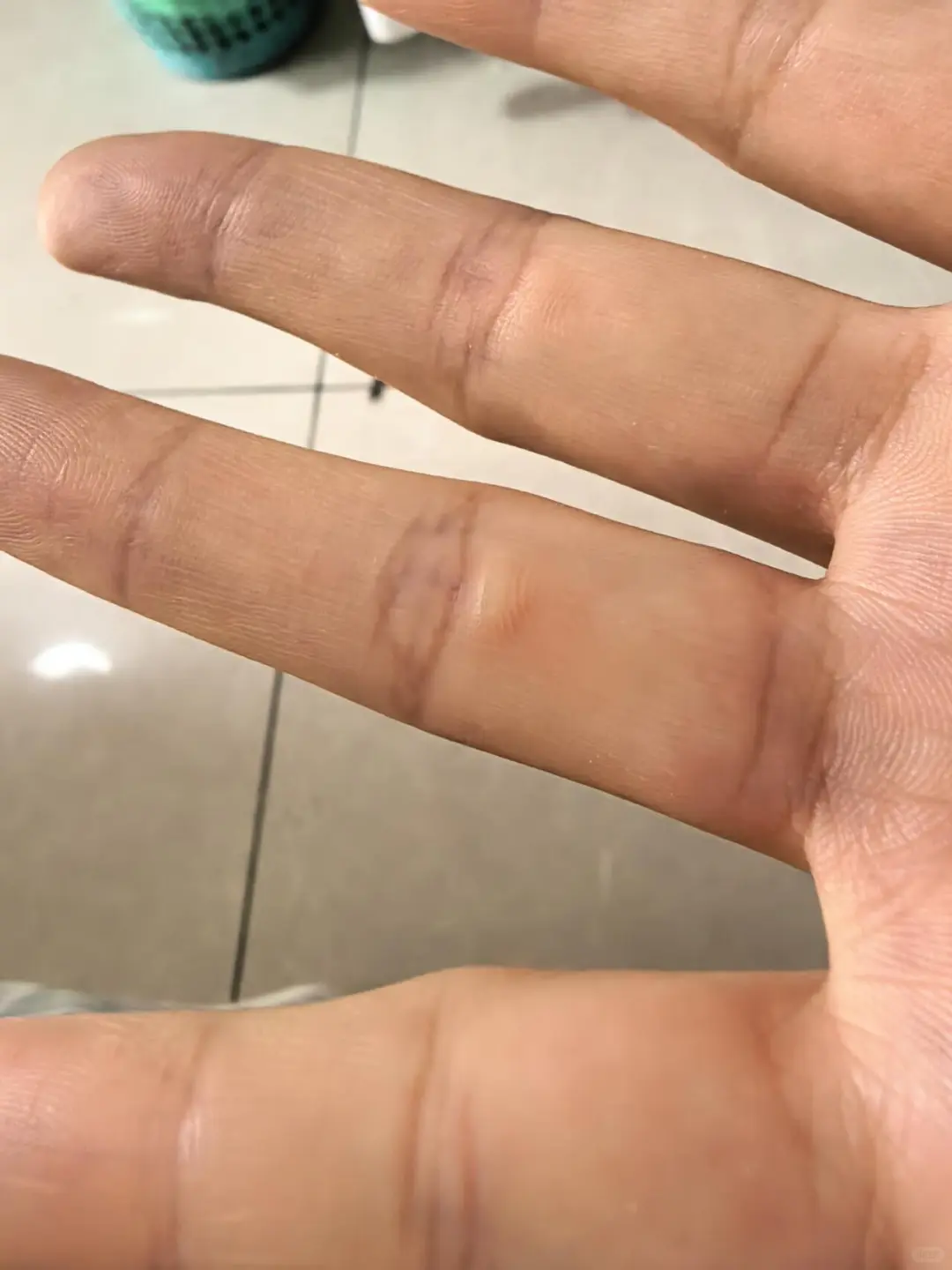 开了个店天天焦虑得想亖