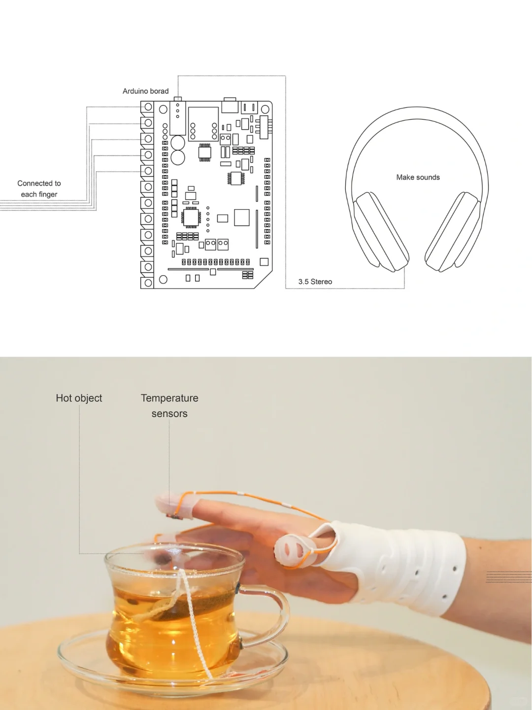 交互设计｜为无痛患者设计的可穿戴康复装置