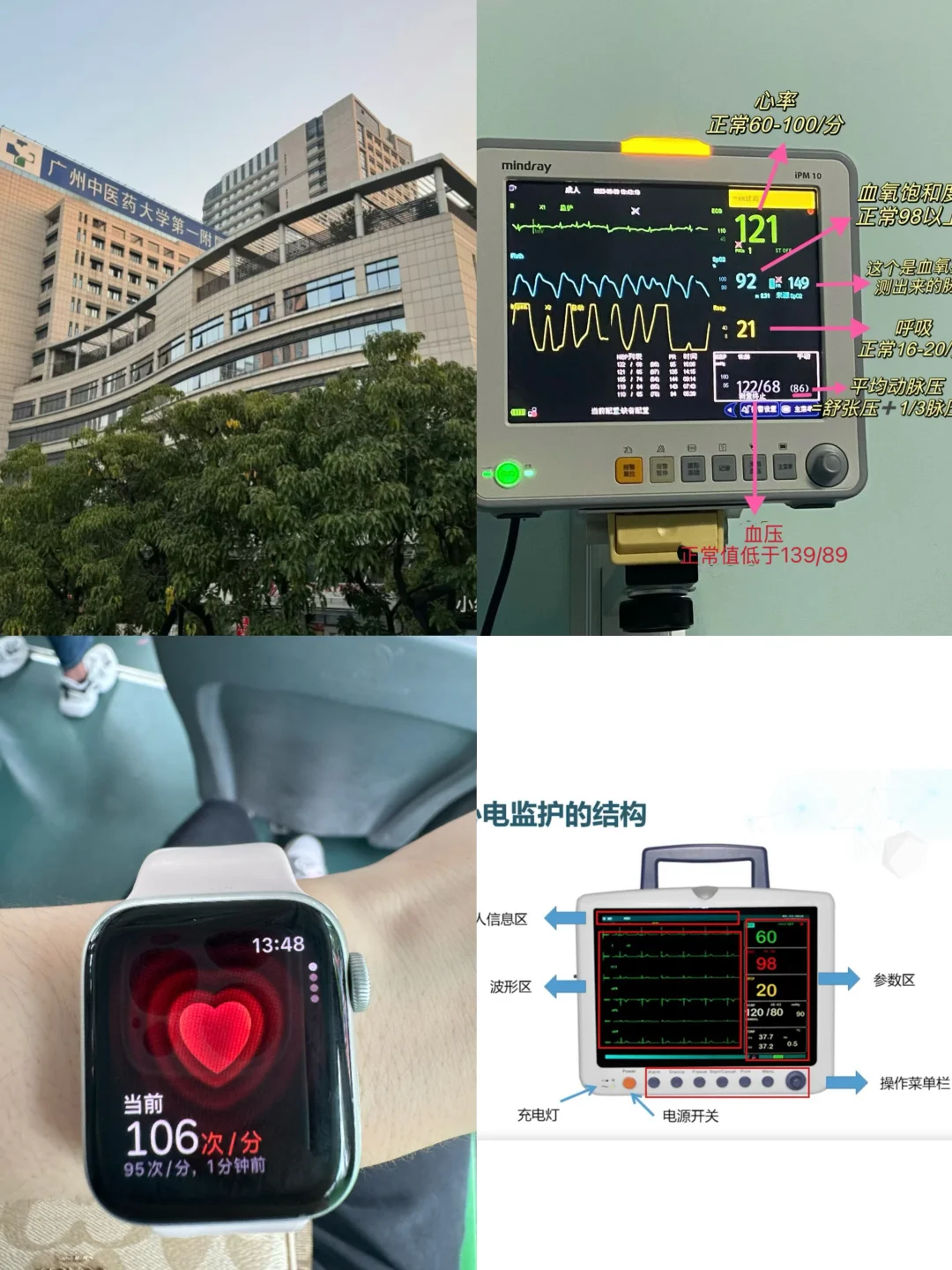 麻醉护士上线！天天用心电监护你掌握了多少