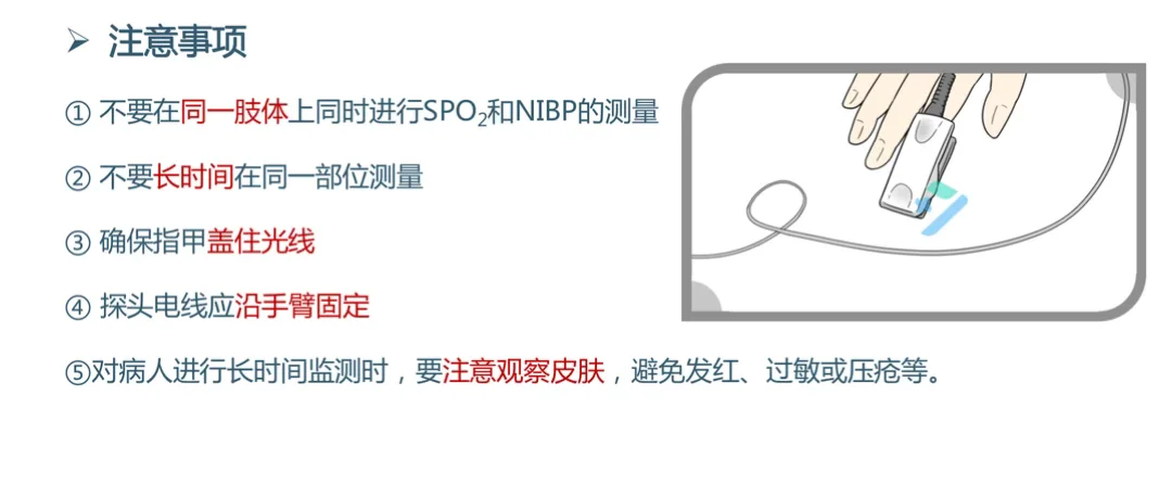 麻醉护士上线！天天用心电监护你掌握了多少