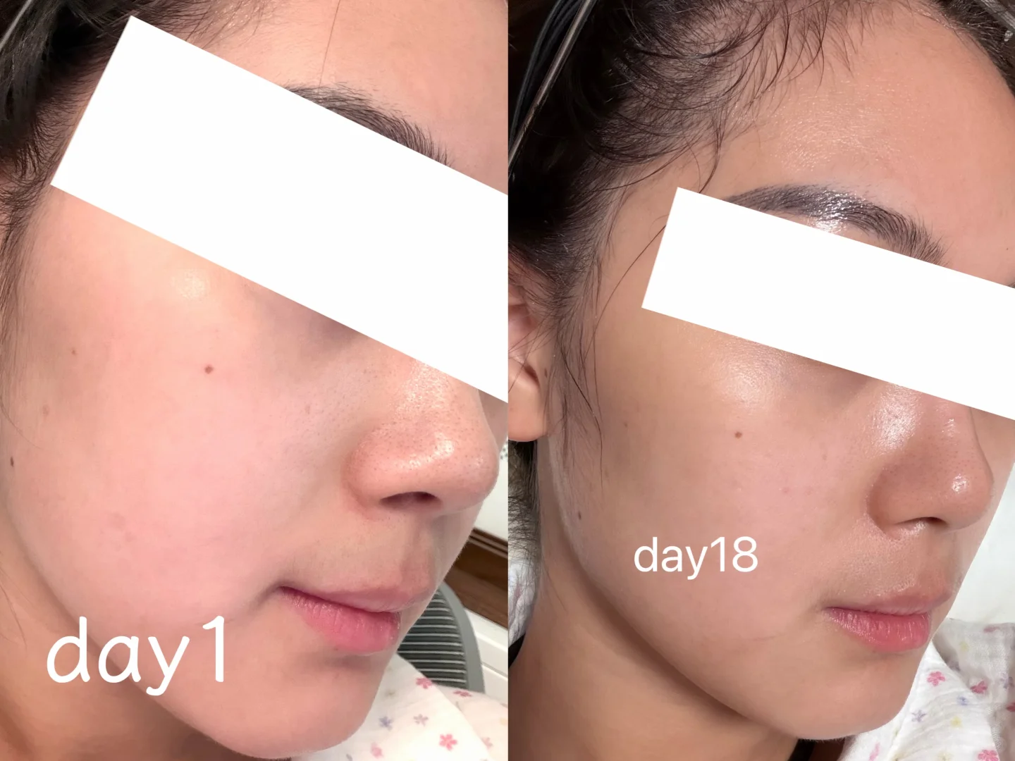 day18｜跟着骆王宇打卡的第18天