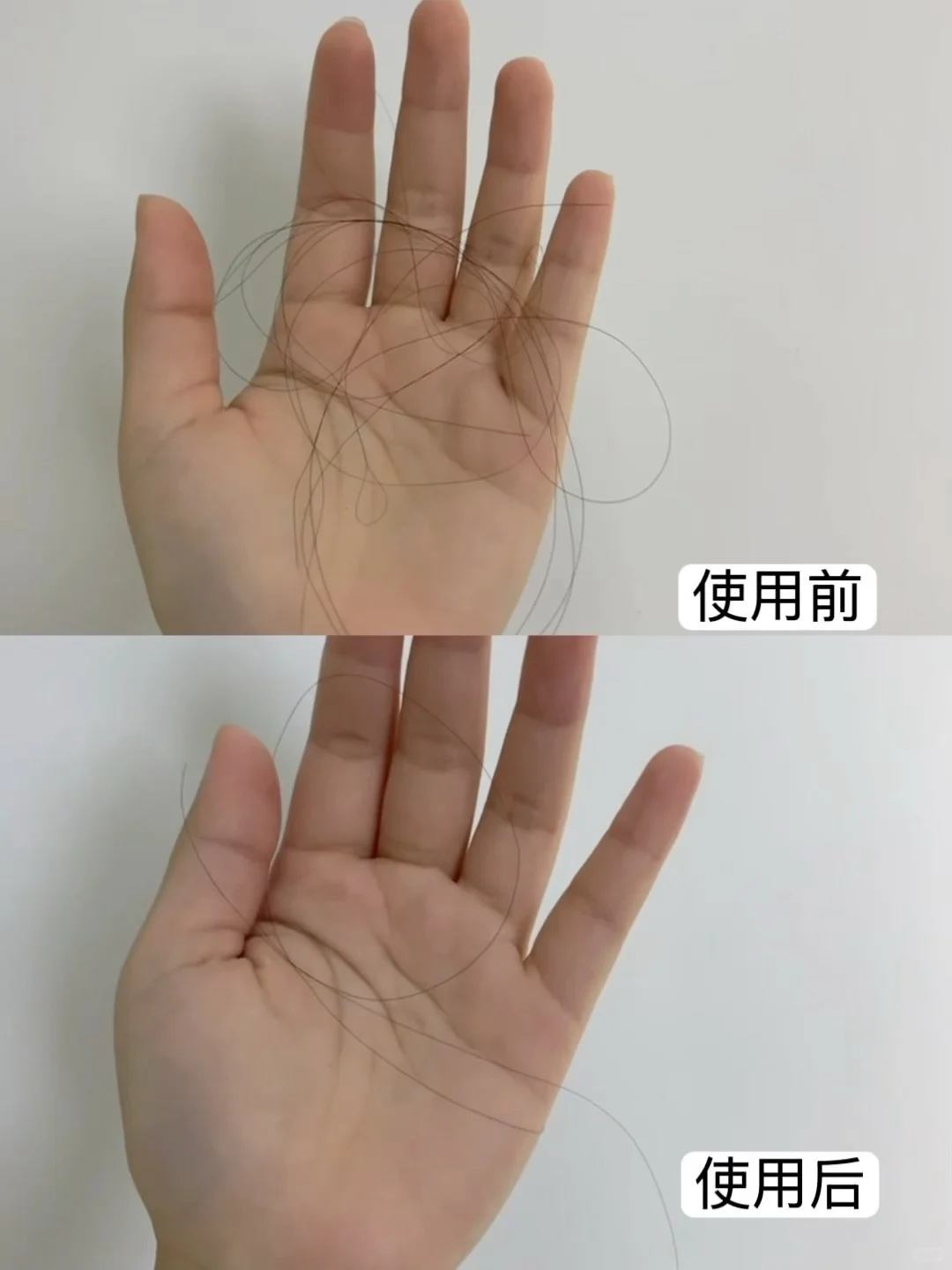 妈宝女真的爱！！防脱?！