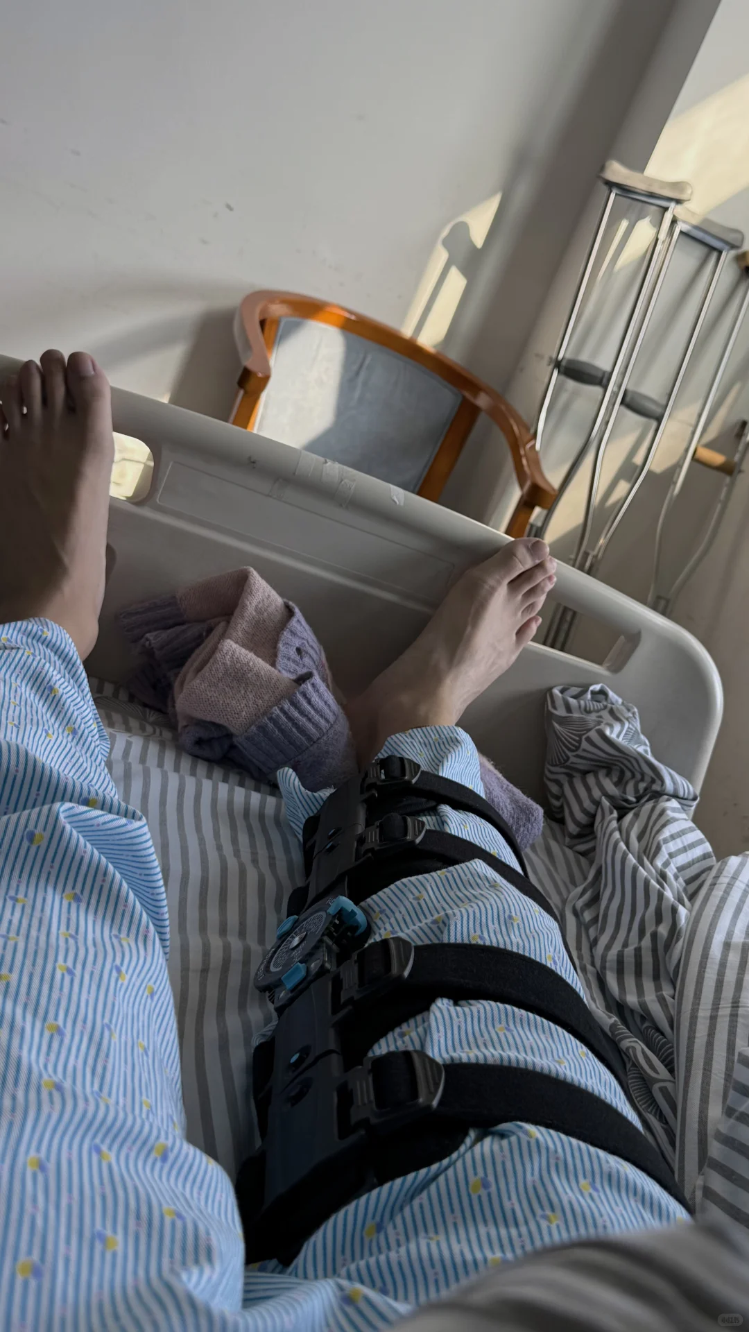 南京ACL重建手术 人工韧带