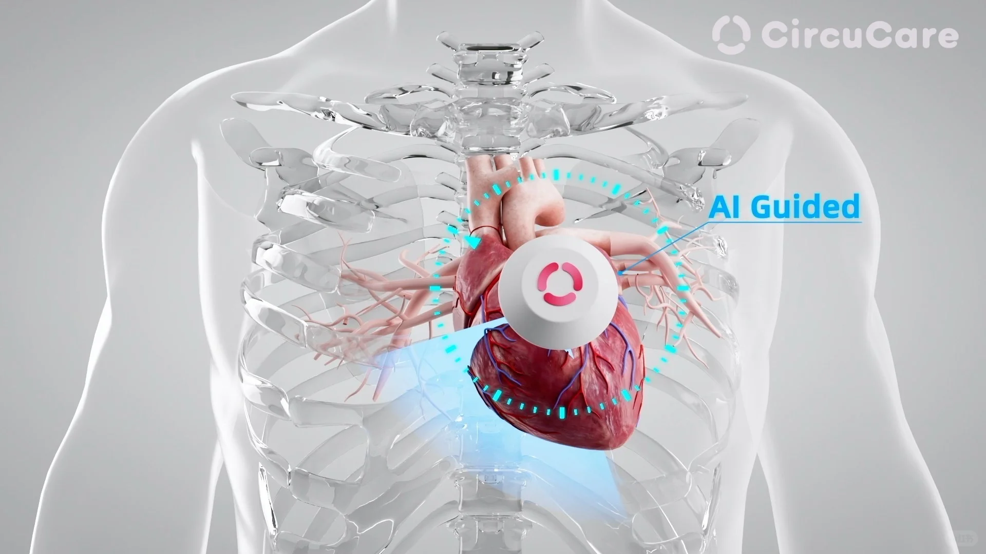 科研人创业记：把超声设备做到“随身携带”