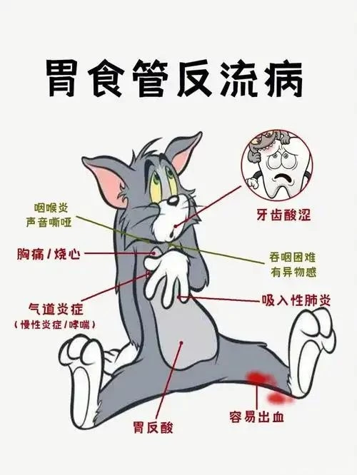 胃食管反流,消化内镜快速修复!