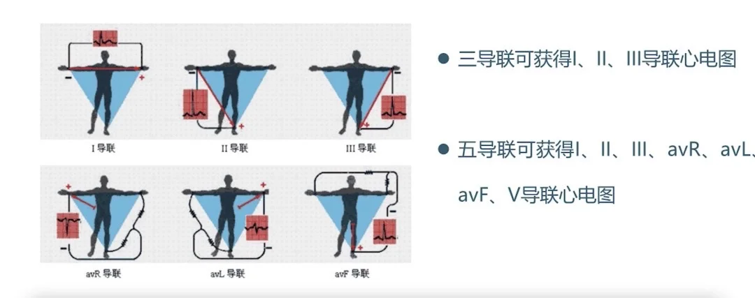 麻醉护士上线！天天用心电监护你掌握了多少