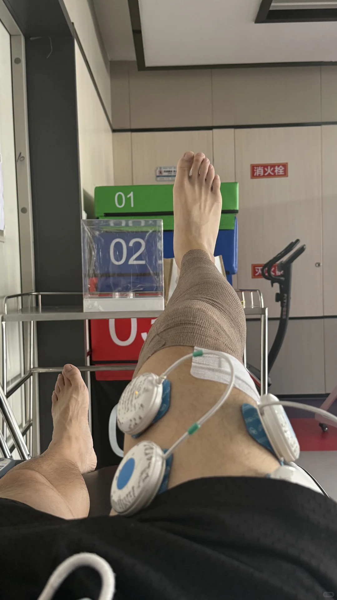 南京ACL重建手术 人工韧带