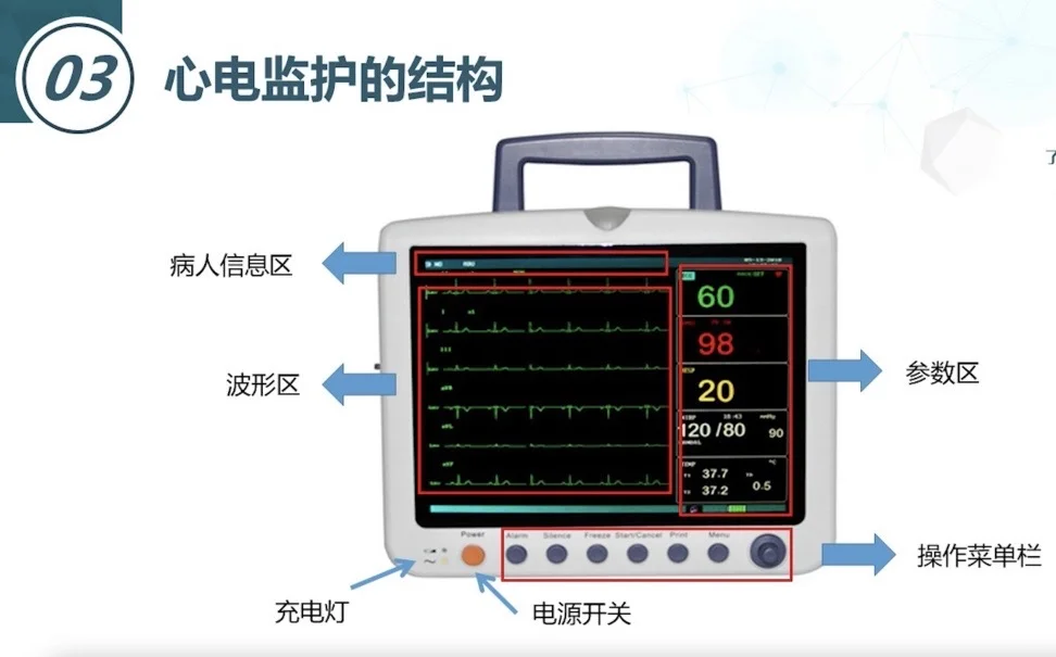 麻醉护士上线！天天用心电监护你掌握了多少