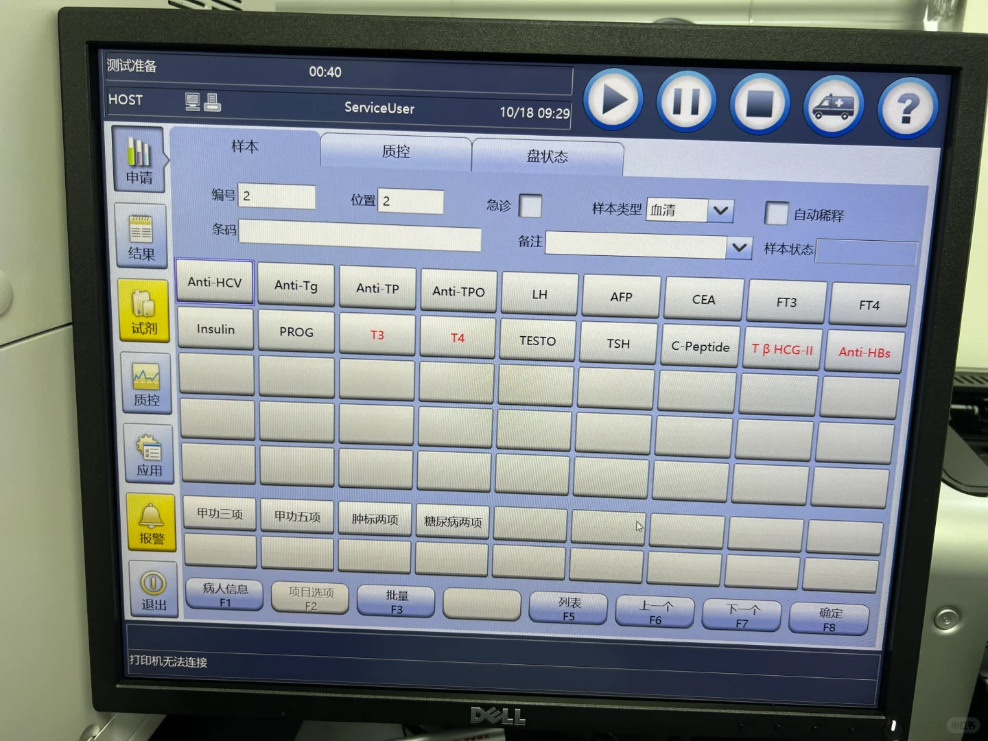 关于我一手参与建设的检验科?之发光分析仪