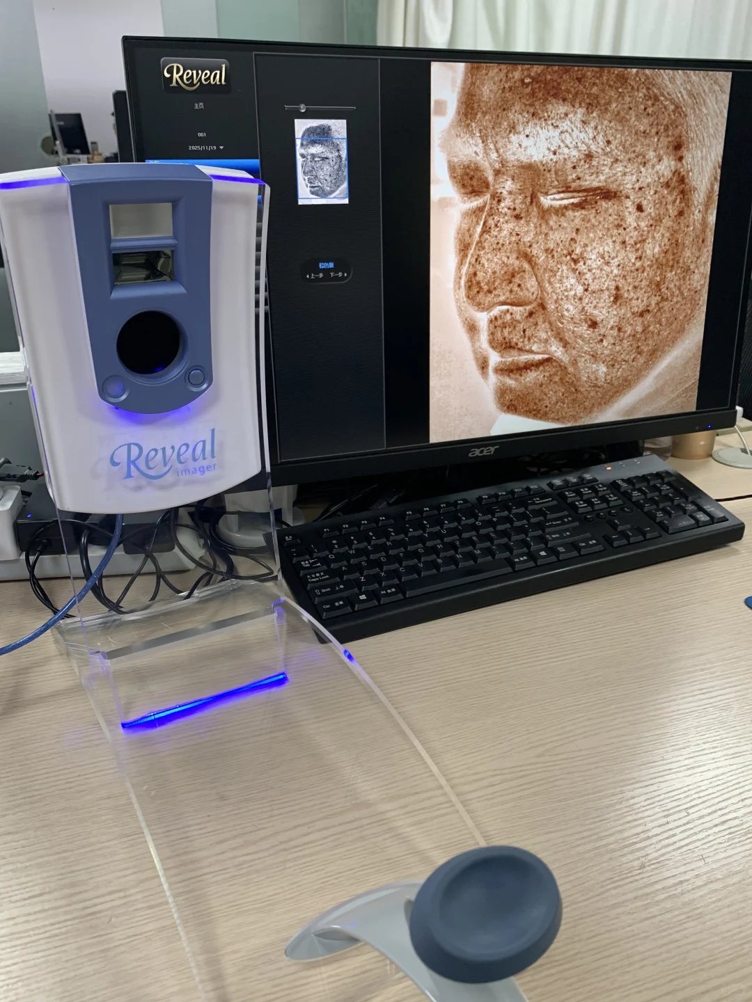 reveal皮肤检测仪