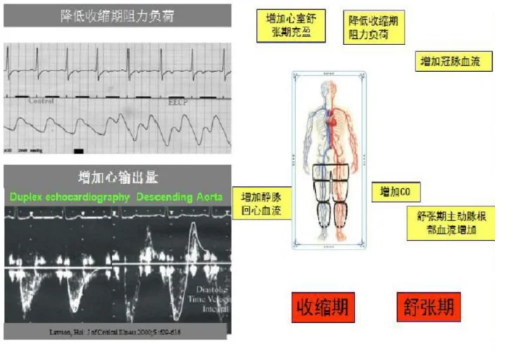 无创“生命加速器”EECP，了解一下？