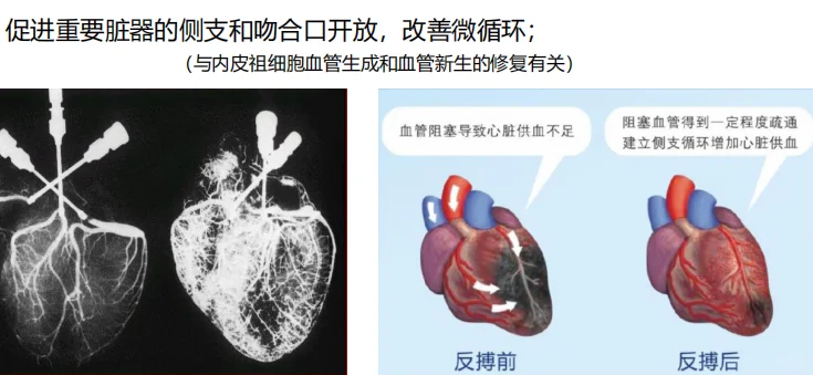 无创“生命加速器”EECP，了解一下？