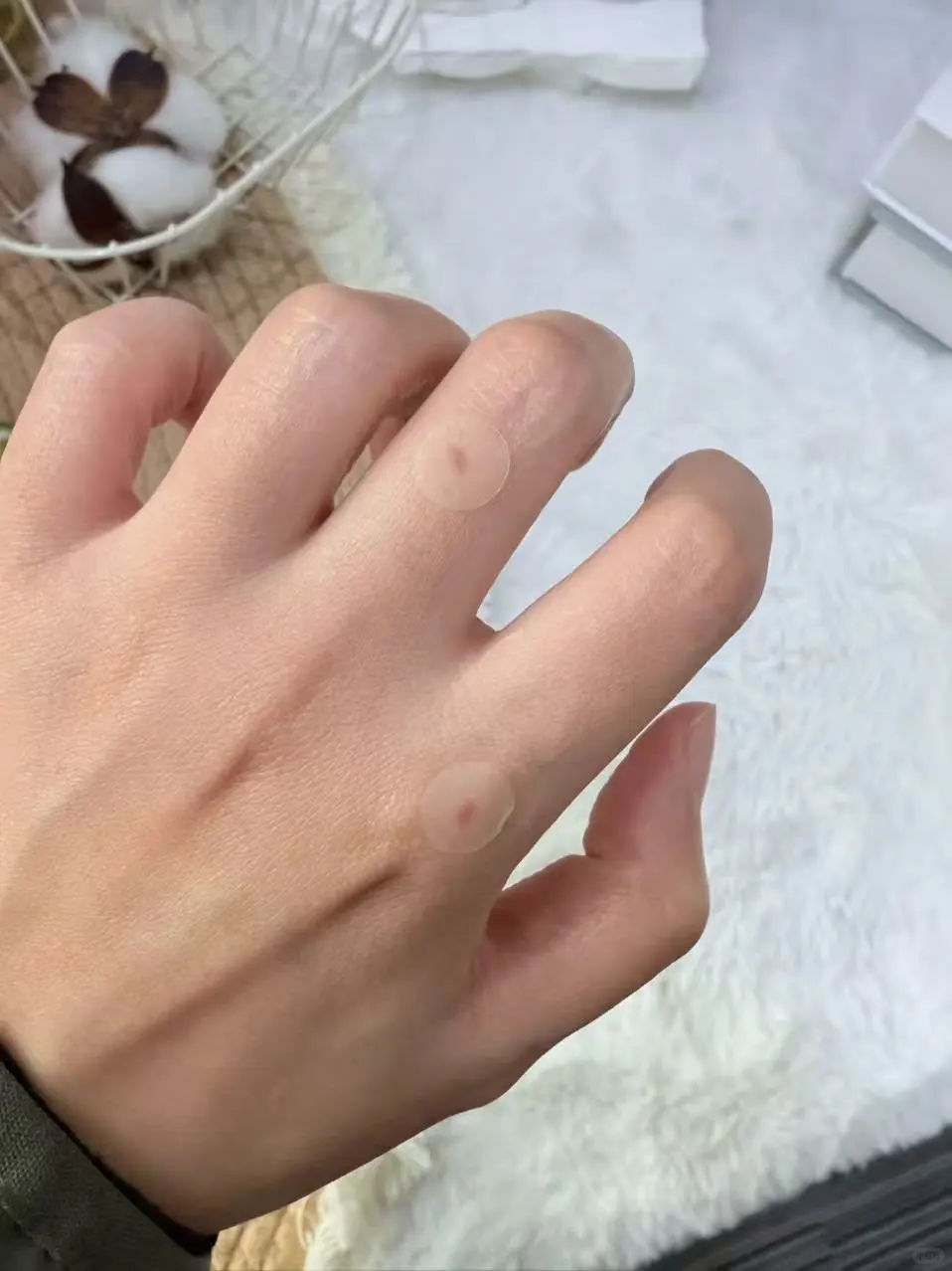 自从发现痘痘贴能贴伤口，就贴完这个贴那个