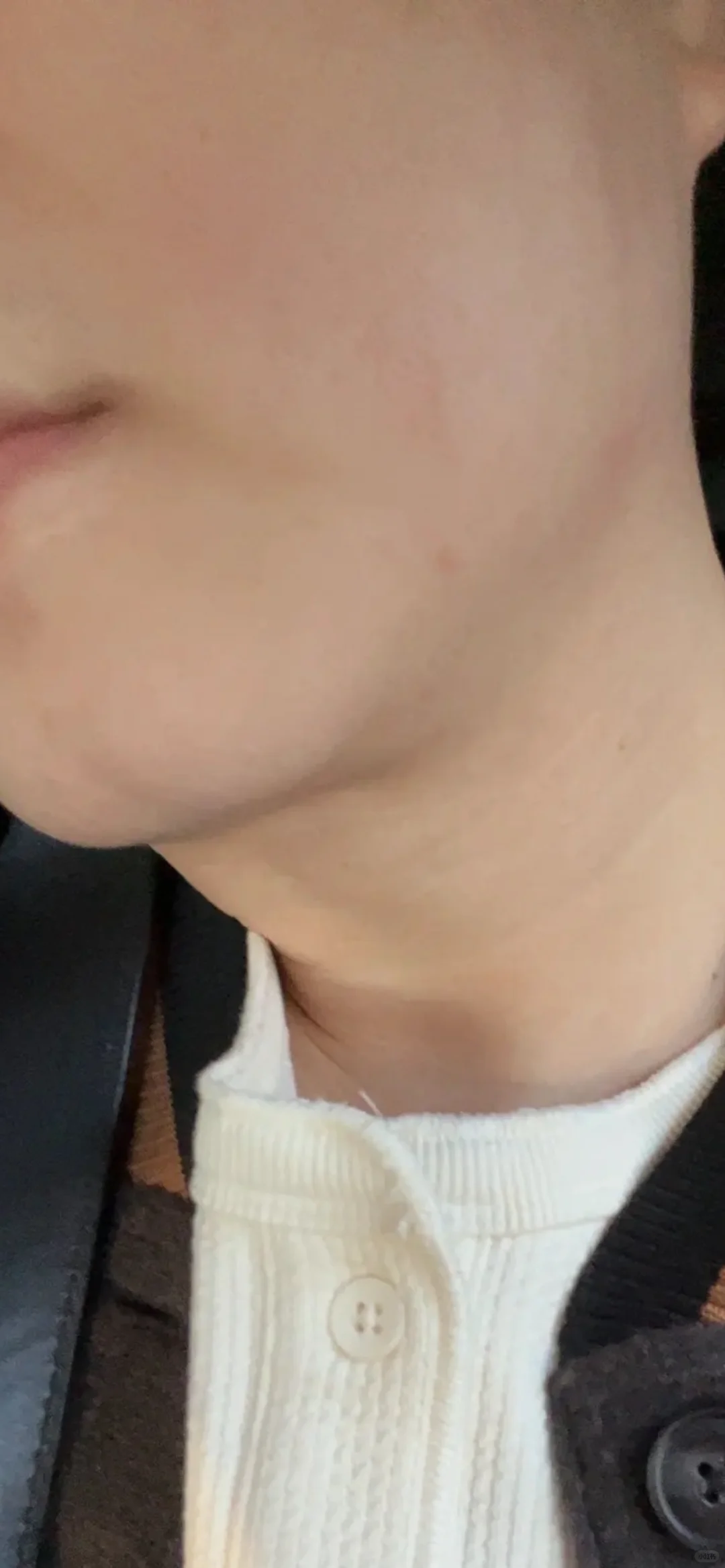 破相拯救篇，微压氧舱助力