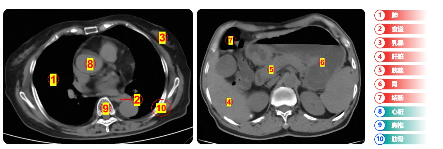 ? 医疗行业的地震！GE联手阿里AI