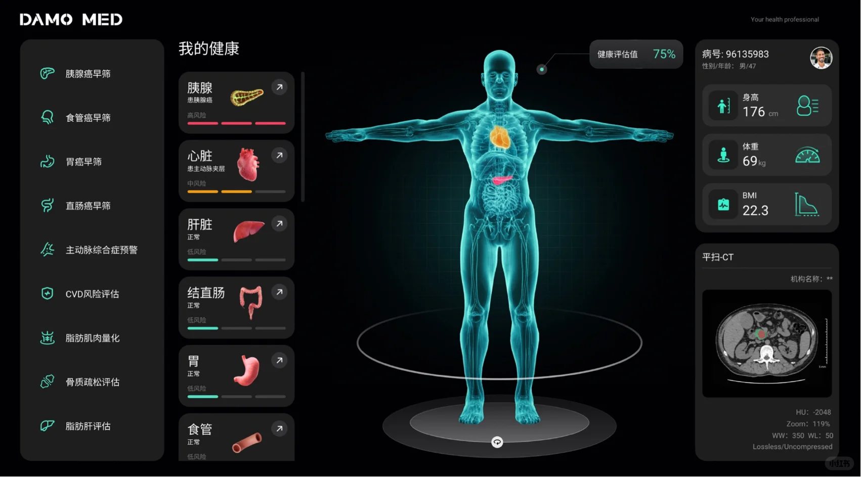 ? 医疗行业的地震！GE联手阿里AI