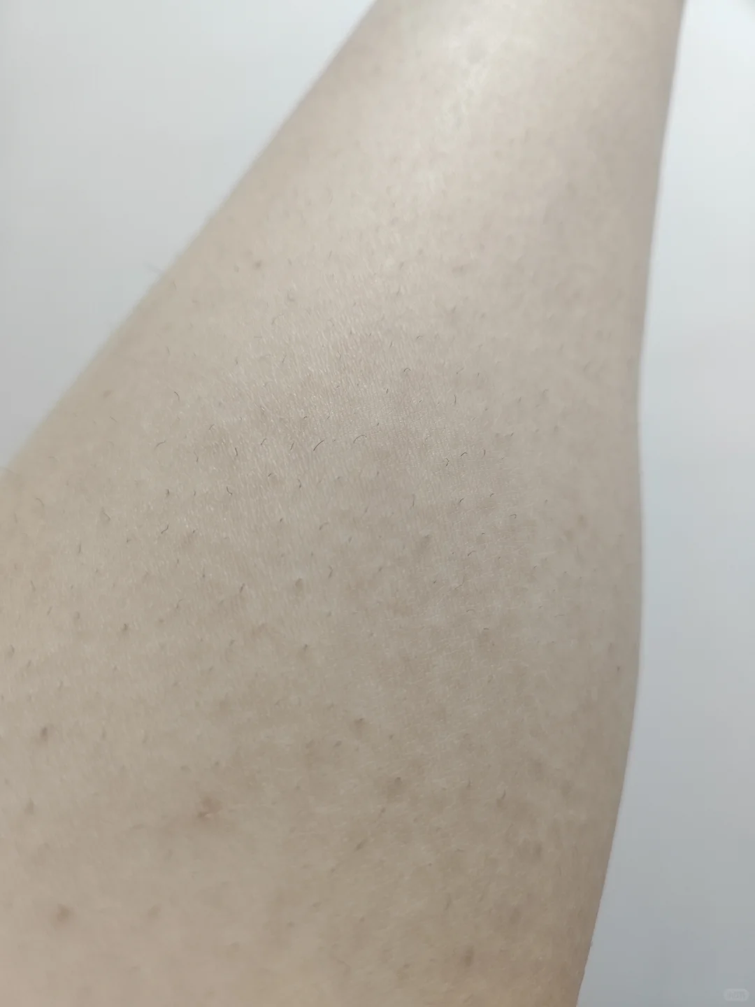 脱毛仪打卡第五天,腿部脱毛第三次