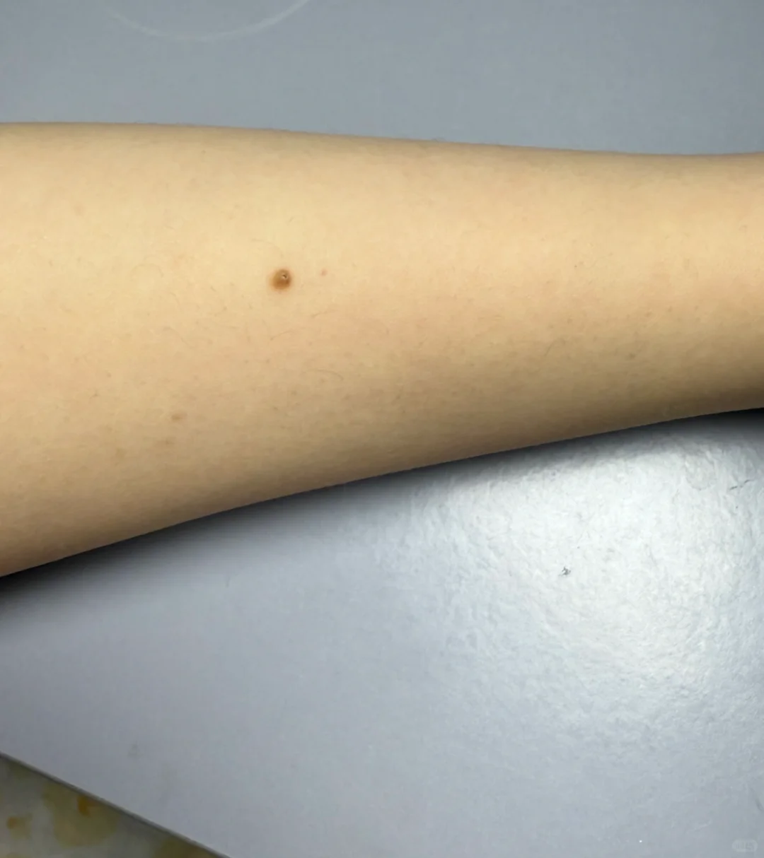 Ulike 脱毛仪打卡记录