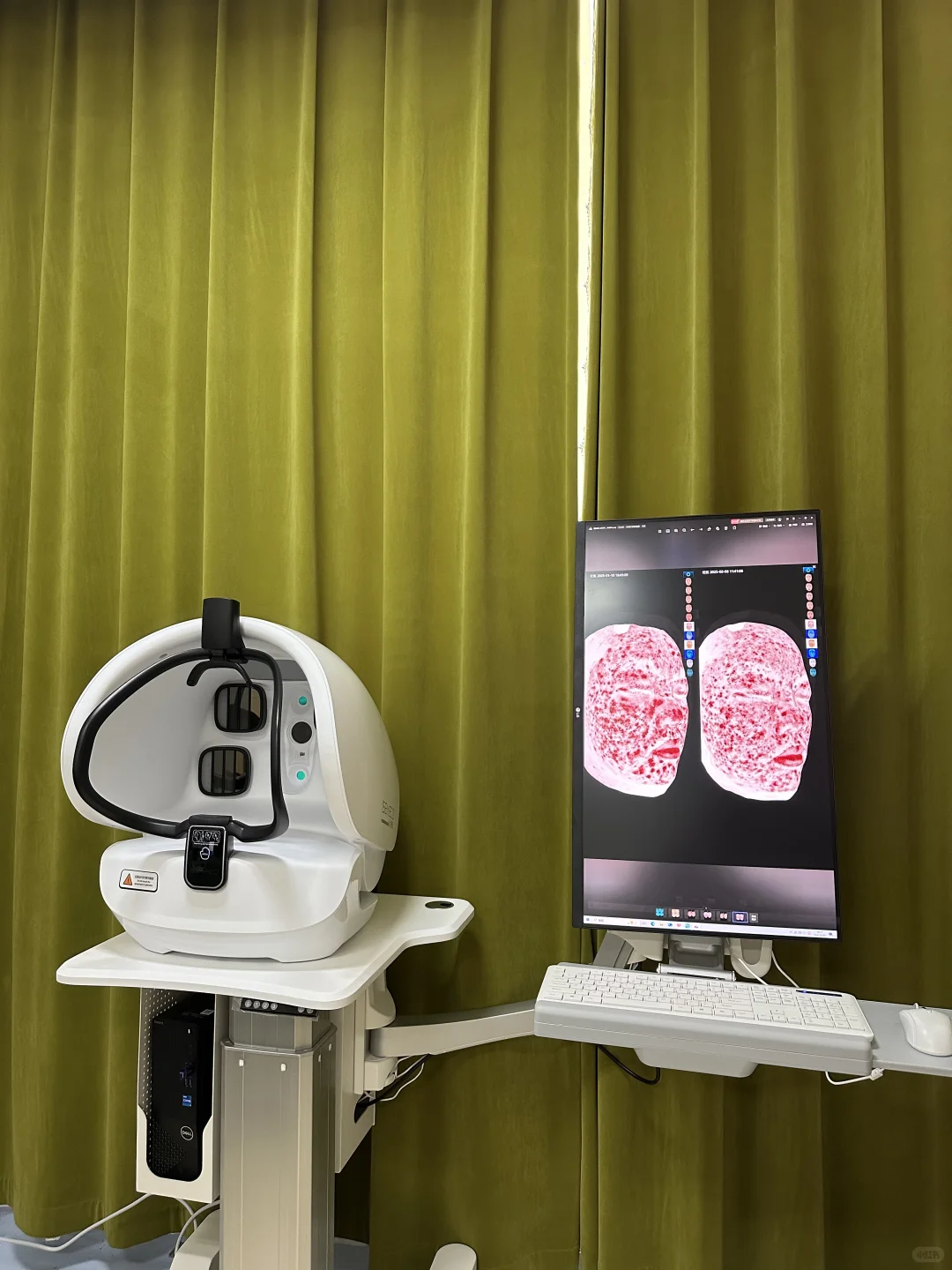 昌吉专业皮肤管理检测仪Ⅰ4200万像素精准检