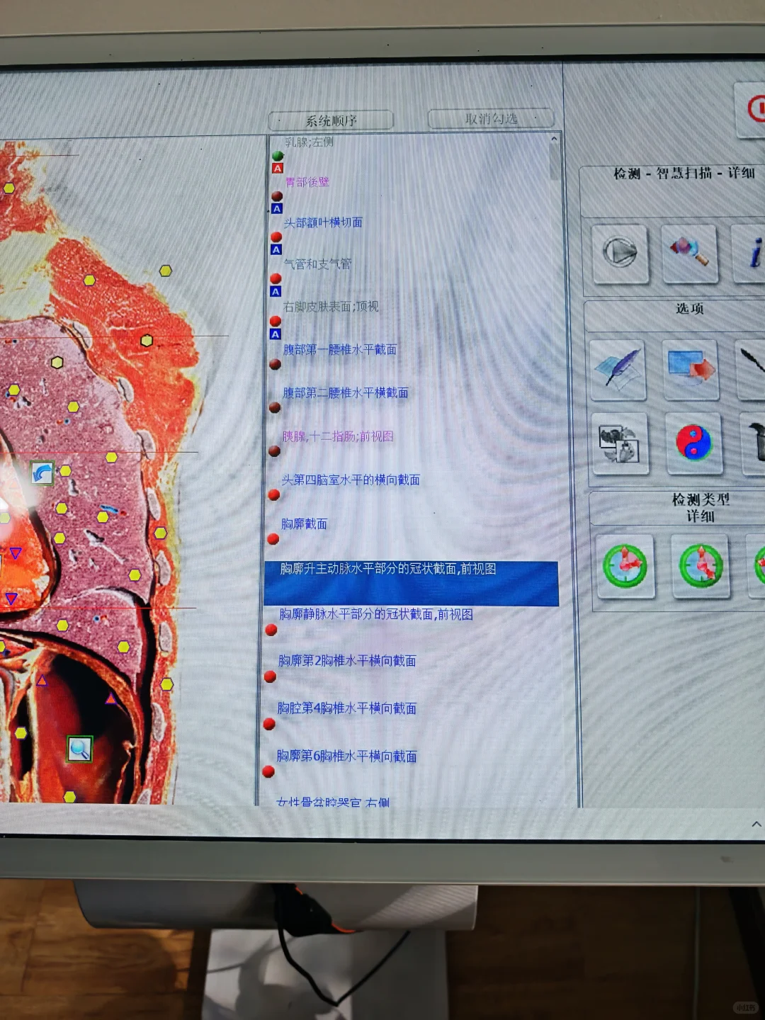 我妈让我来盗龄医生AI检测