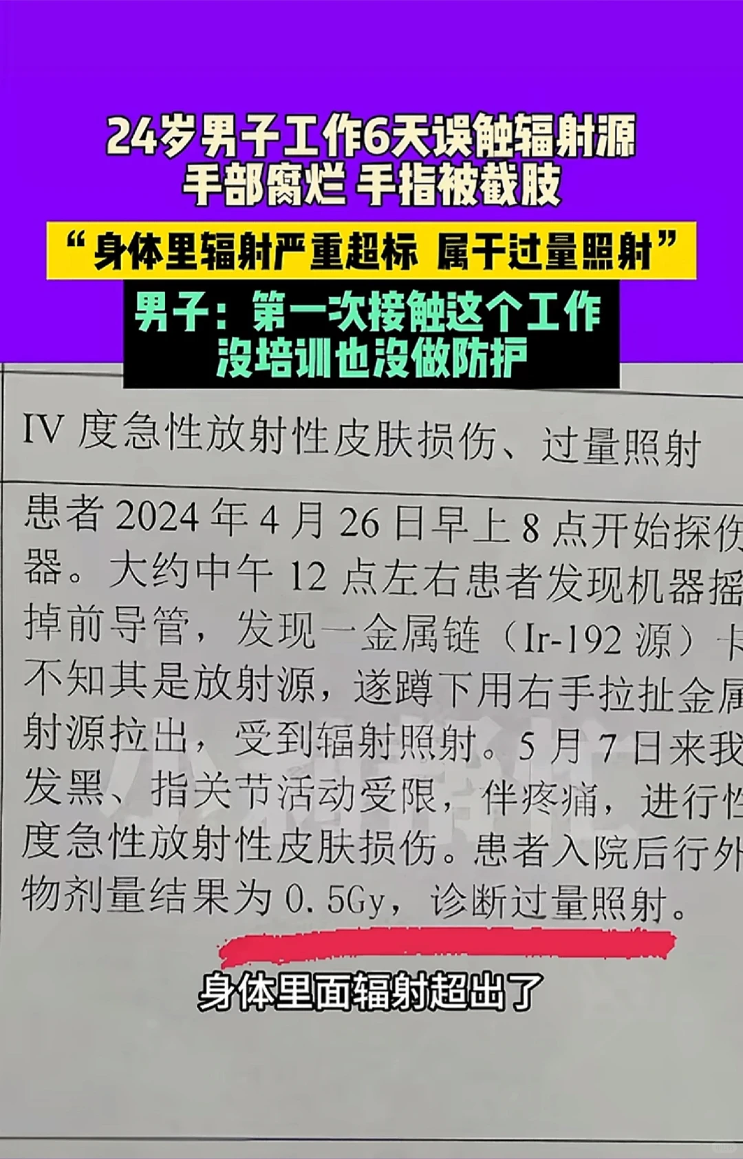 在外面遇到这种形状的金属链条千万别捡