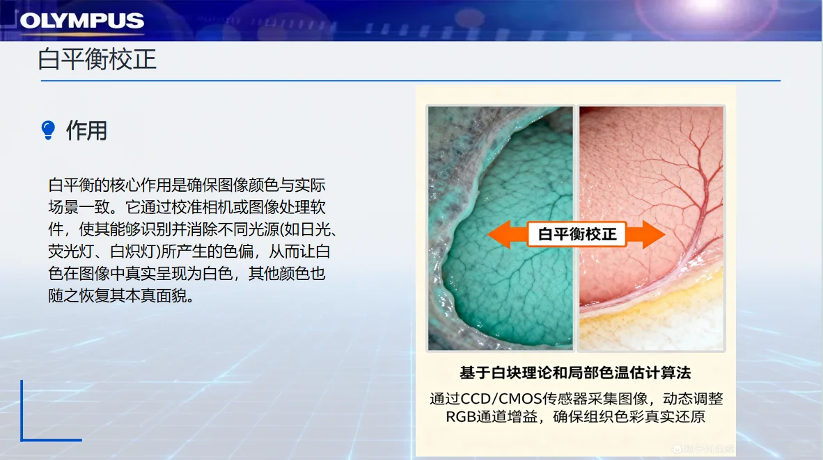奥林巴斯电子内镜结构和原理
