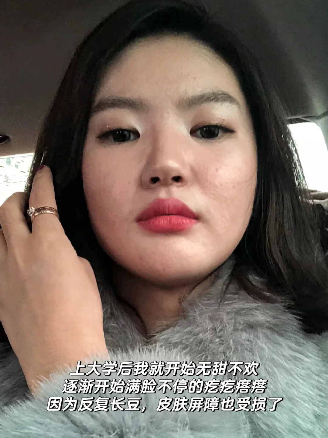 30岁，替大家试过了，控糖可以改变自己的外貌