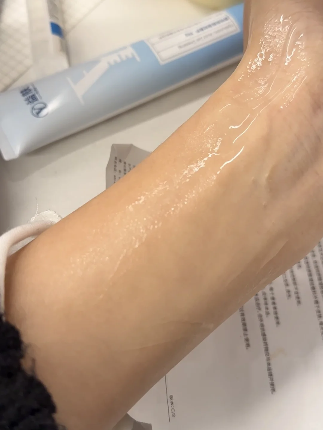 关于我为什么老长痘？特别是下巴