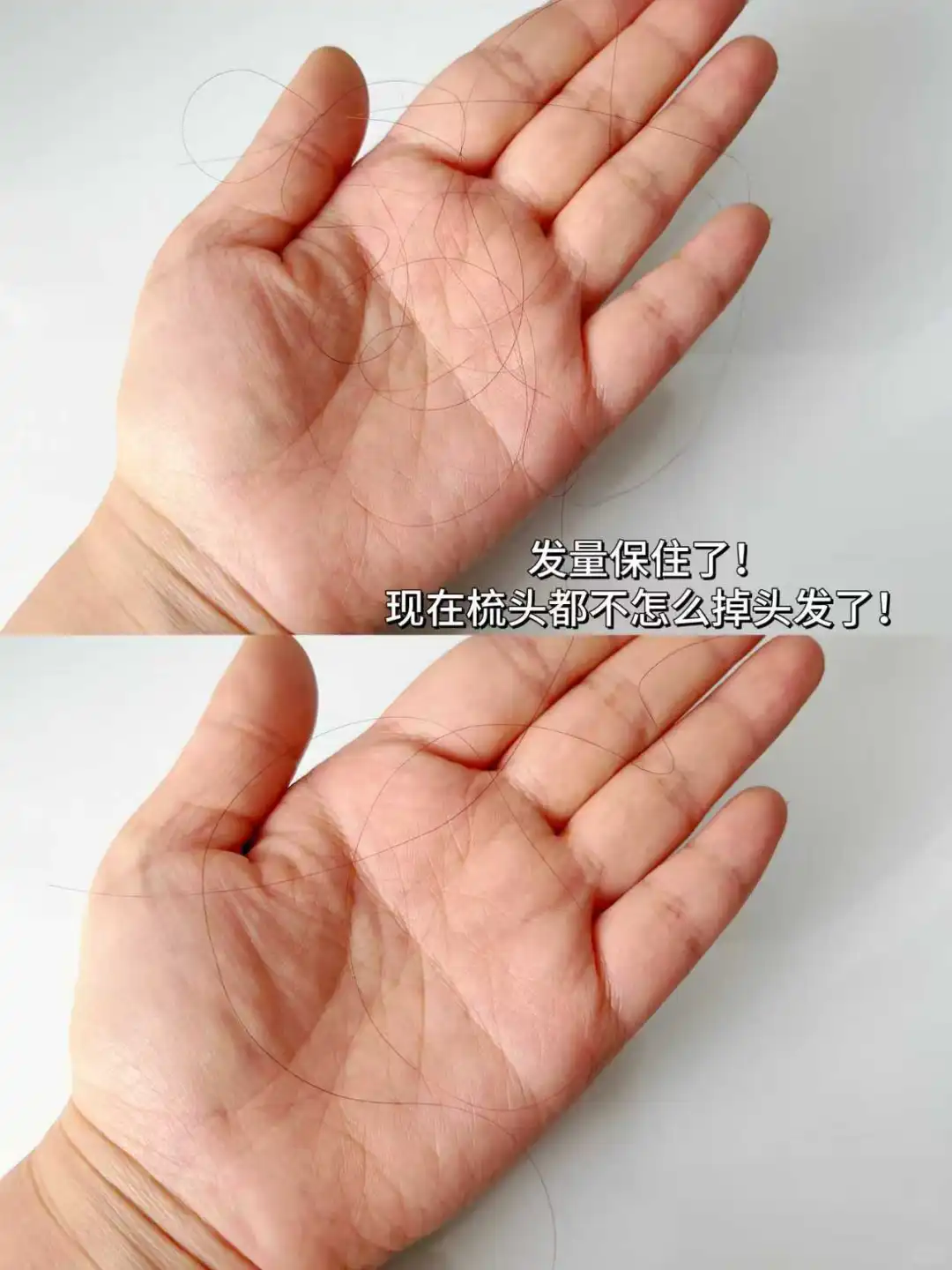 逆袭发量暴发户只需要选对防脱洗发水！！