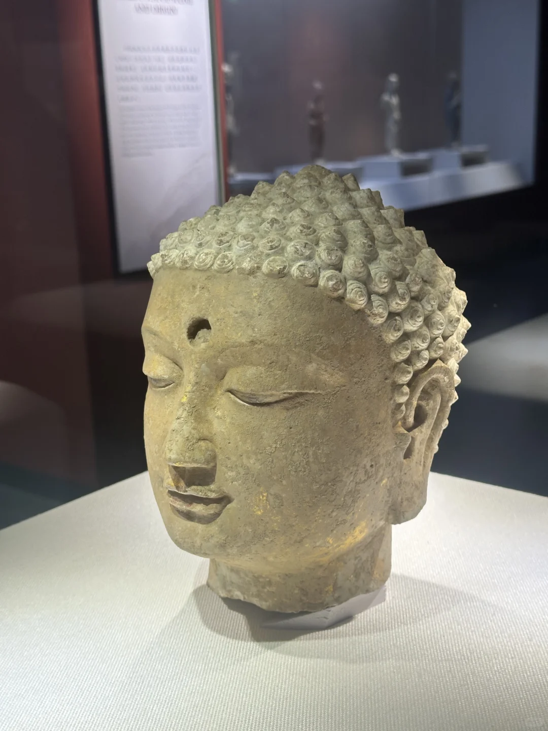 残缺的手臂 依旧可以温暖你的心房