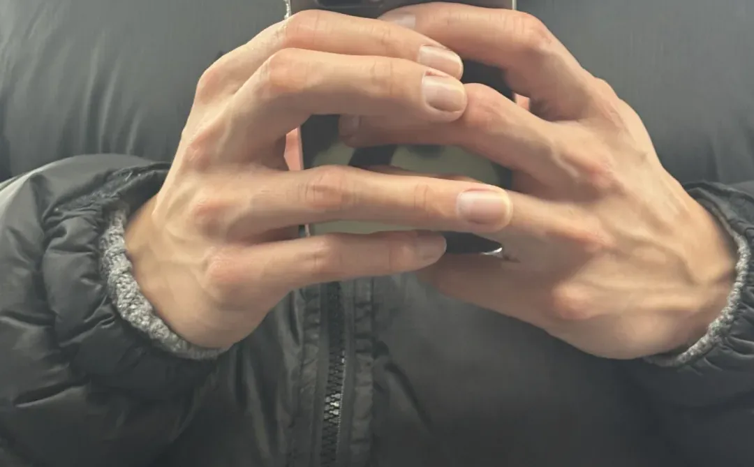 没有背屏应该怎么回应他小米17系列