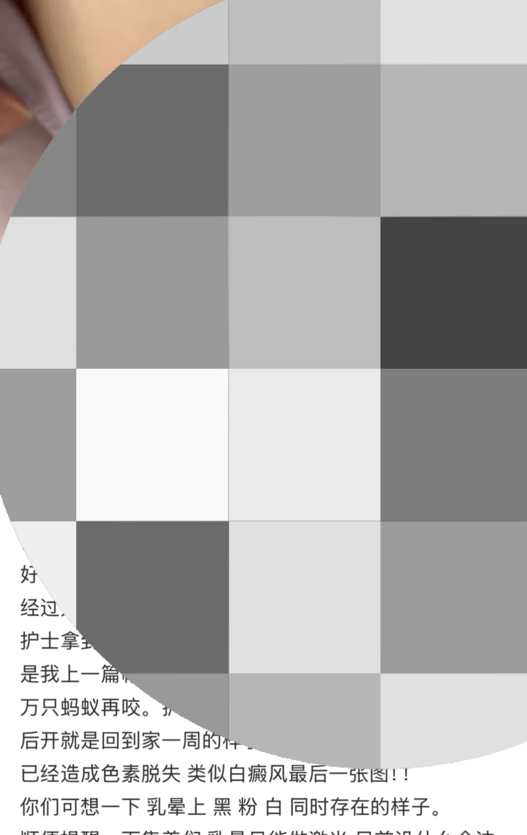 看见有人发帖发?部照片猎奇 神经