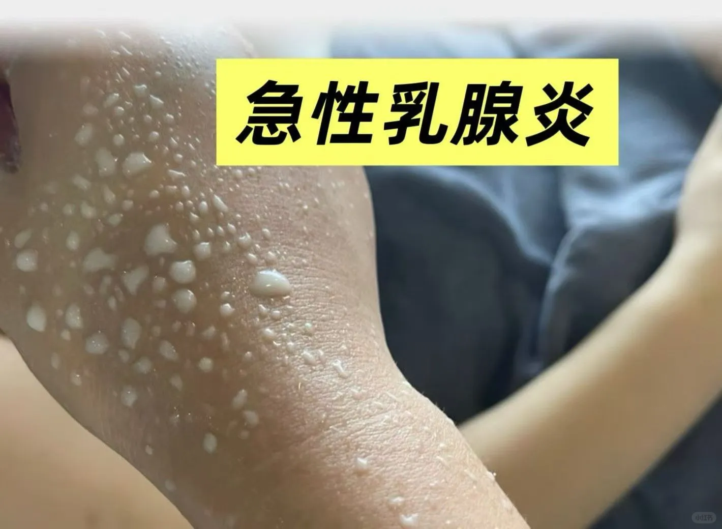 石家庄24小时上门通乳