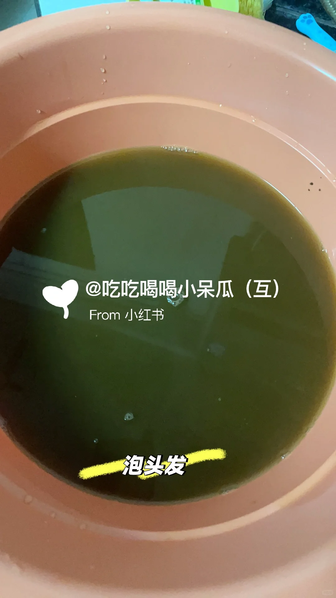 告别脱发，不做秃头小宝贝