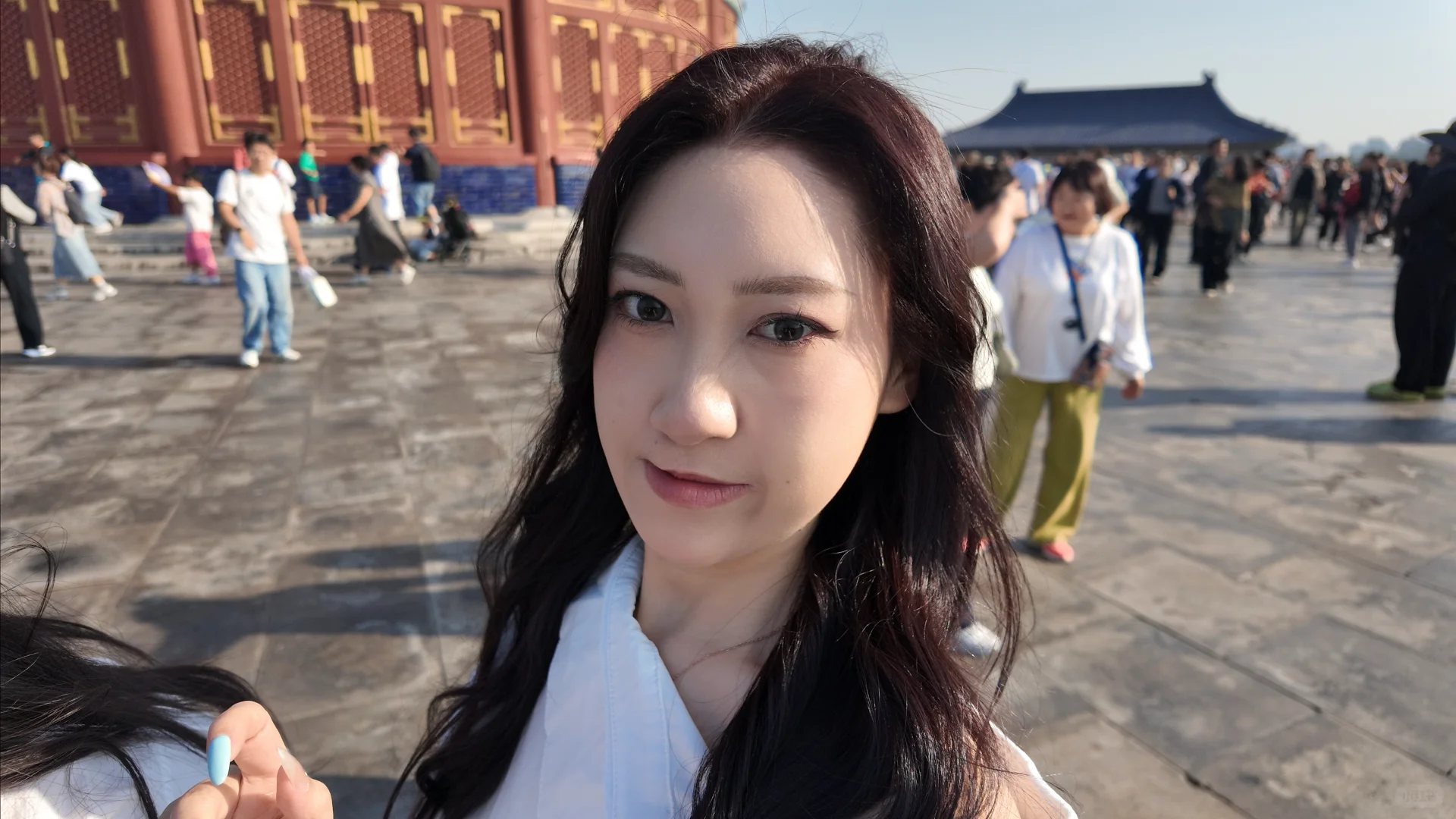 大龄深圳正畸，年龄不应该是变美阻碍