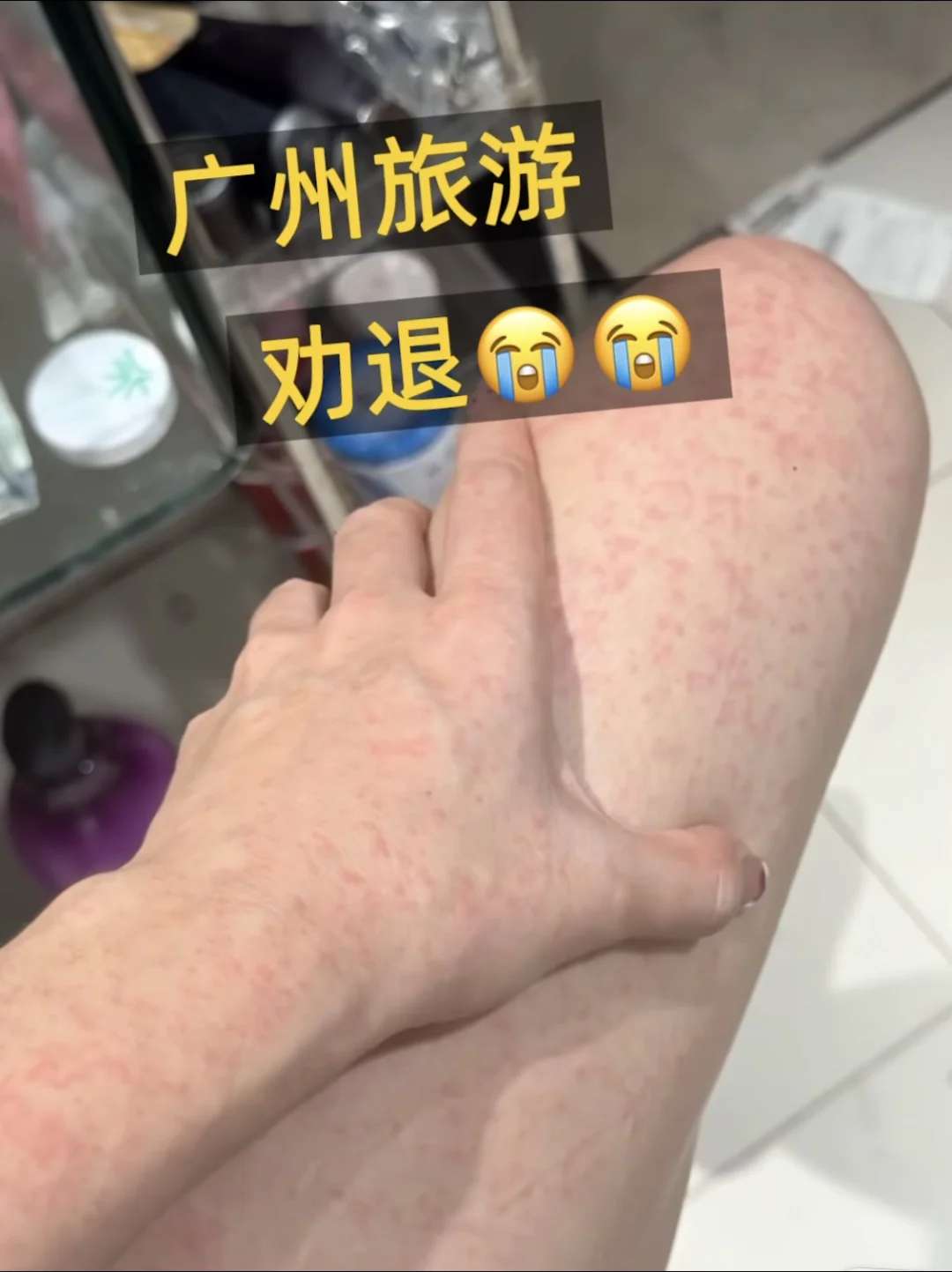 广州已回，已中招。。劝退警告❗️❗️