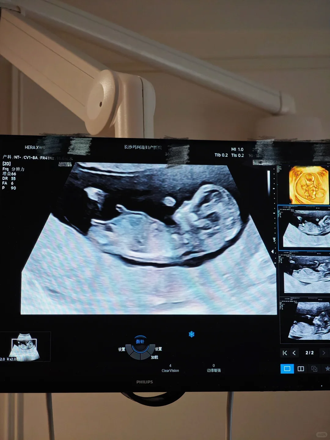 听劝！长沙准妈孕期检查一定要多试几个医院！