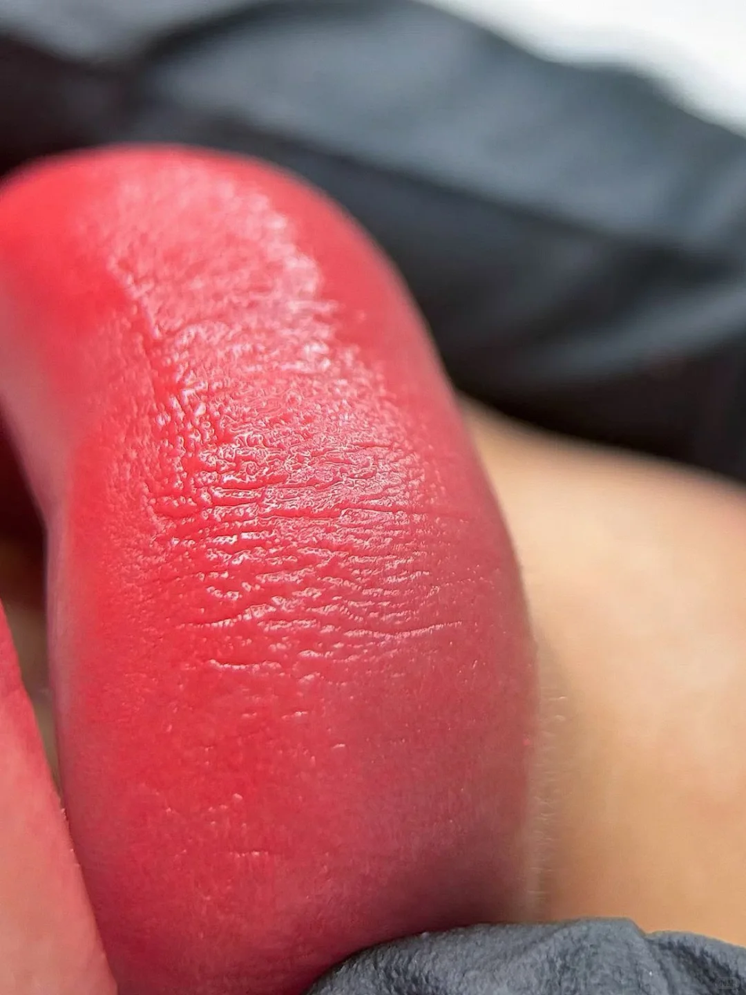 长治纹唇 | 修复唇部纹路 真的绝了