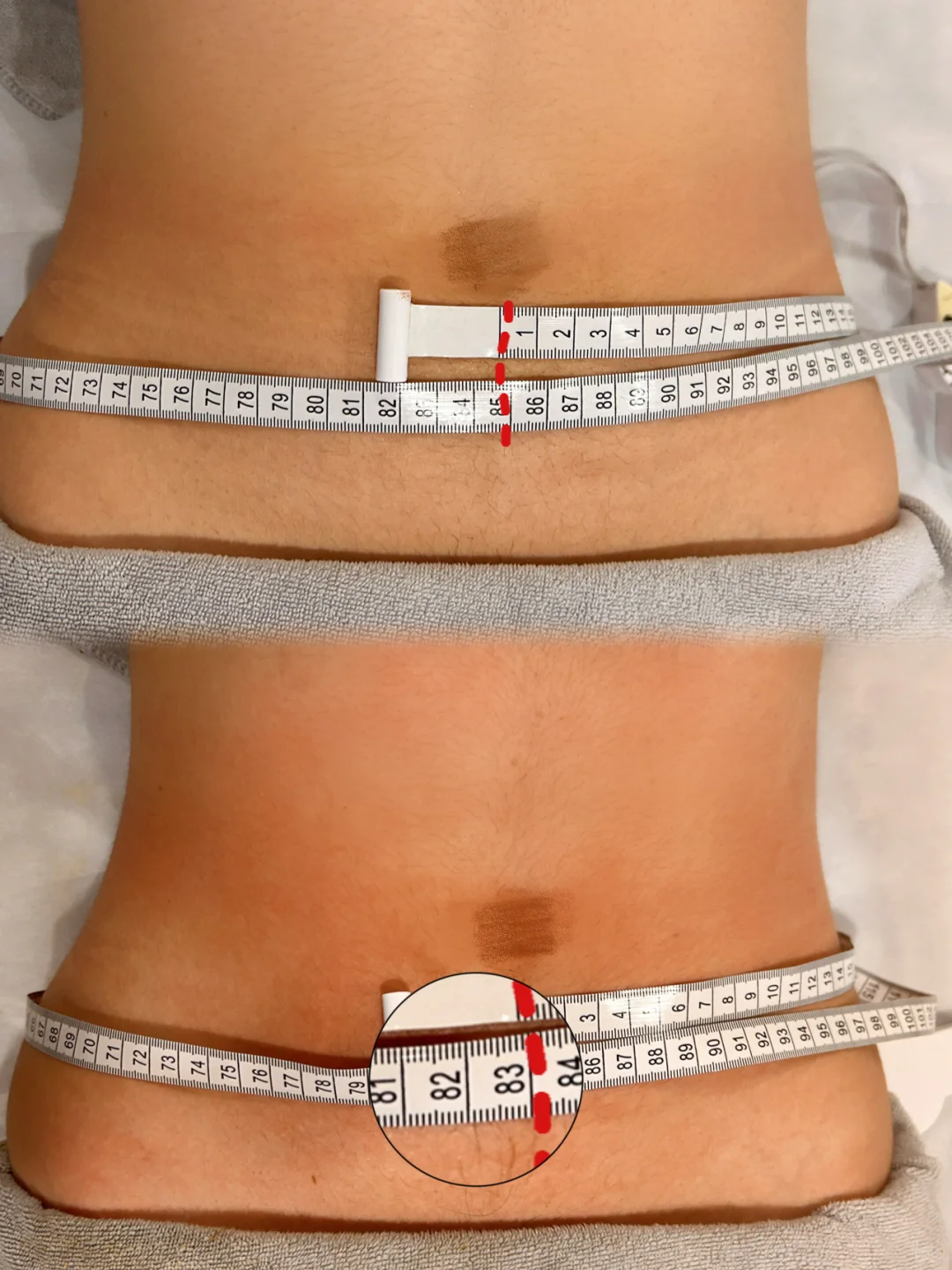 太原变美捷径！重塑派：肉眼可见的效果