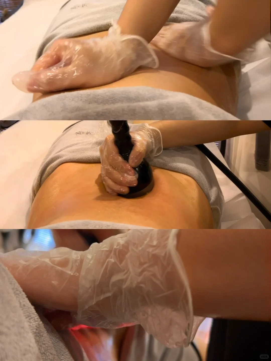 太原变美捷径！重塑派：肉眼可见的效果