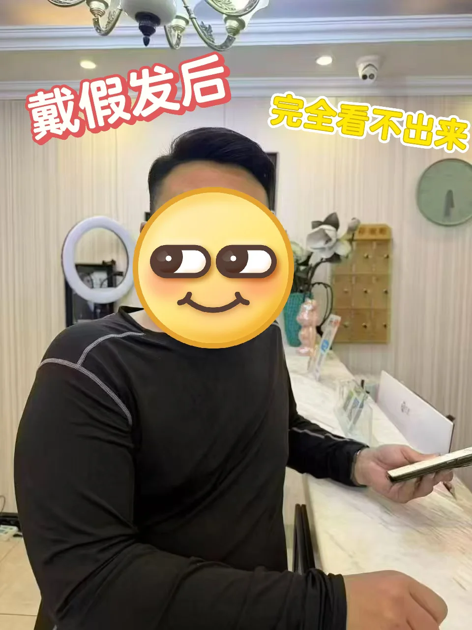 郑州男生脱发自救！这家假发工厂店让你年轻5