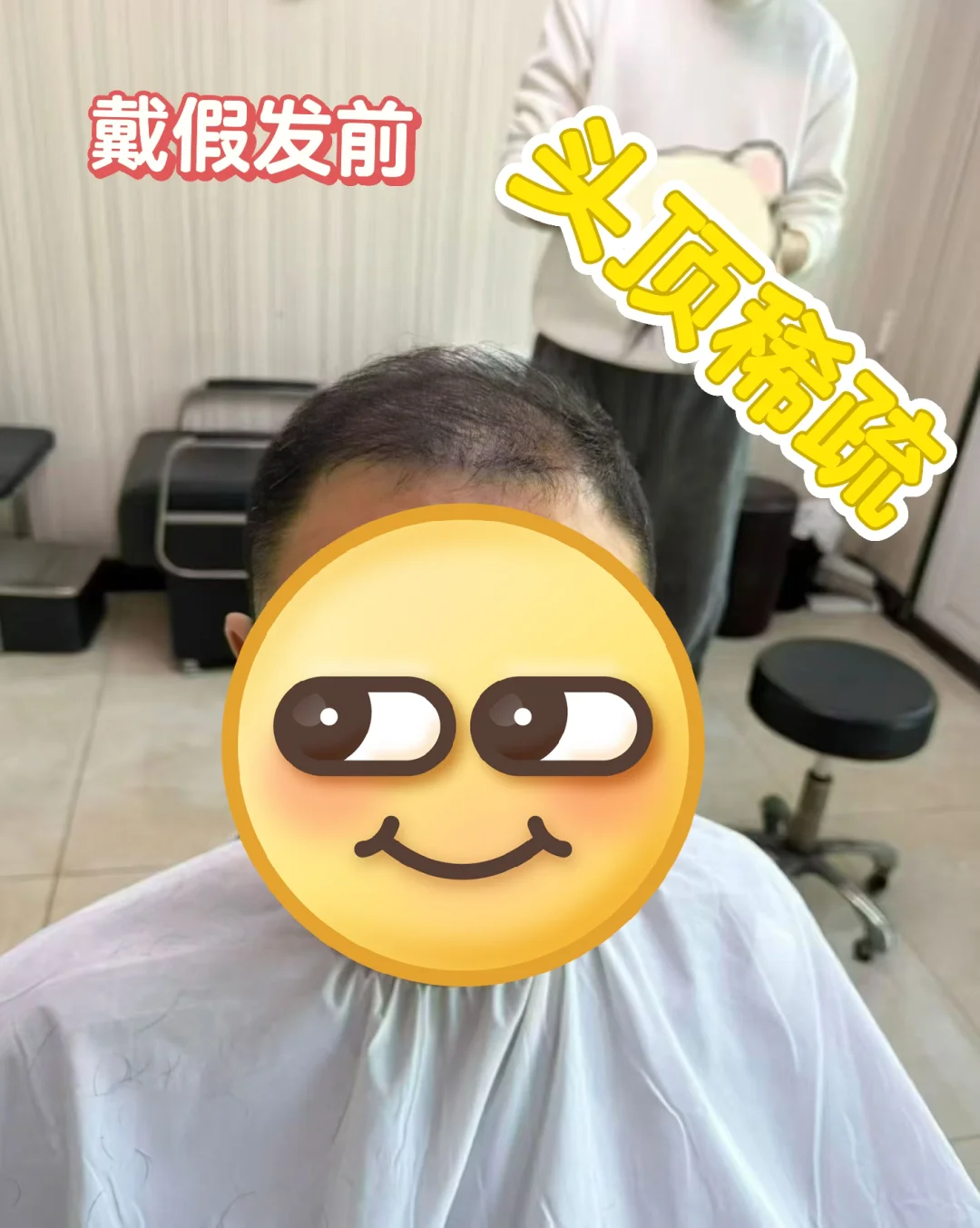 郑州男生脱发自救！这家假发工厂店让你年轻5