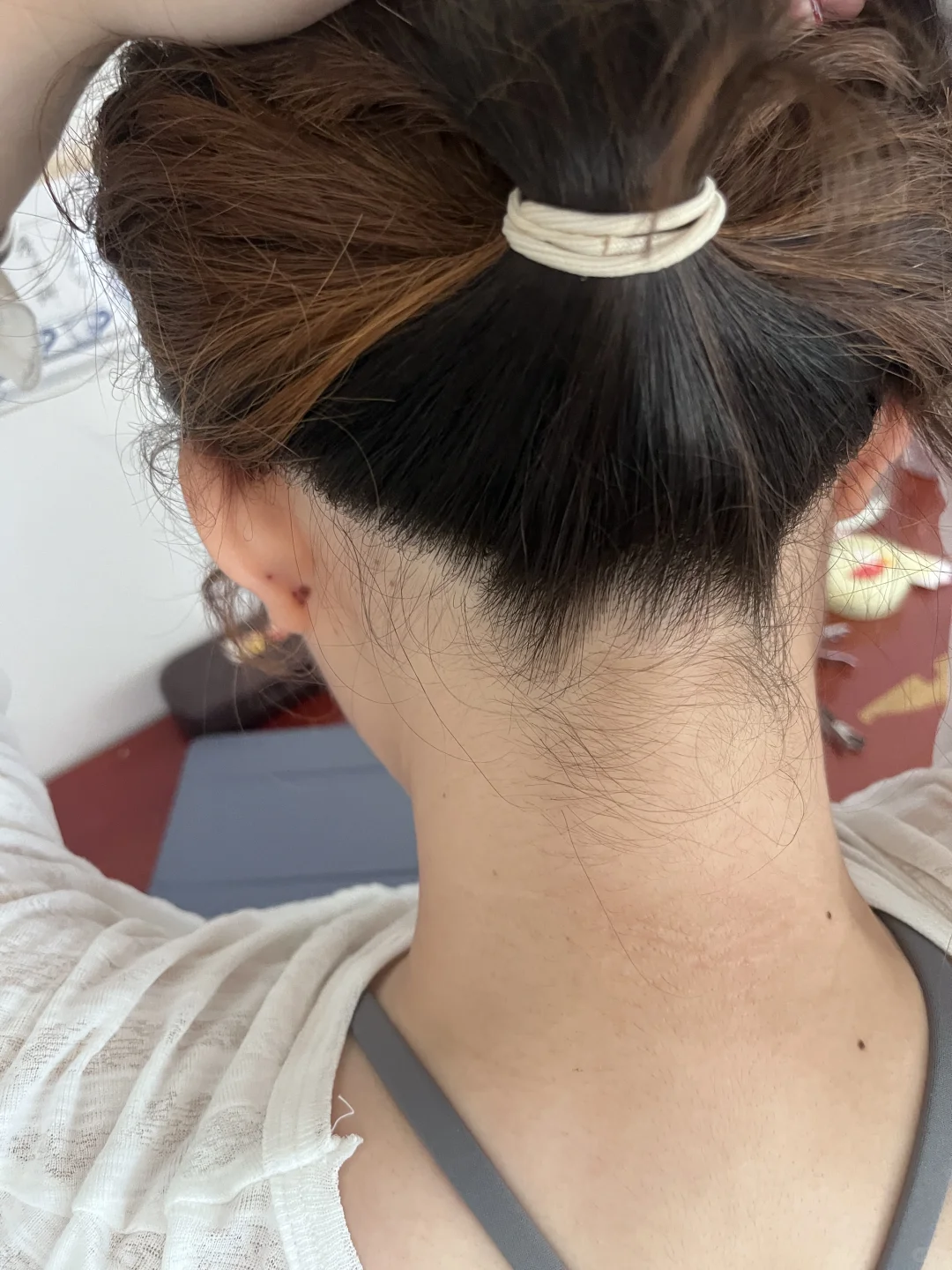 这是胰岛素抵抗好转的现象吗