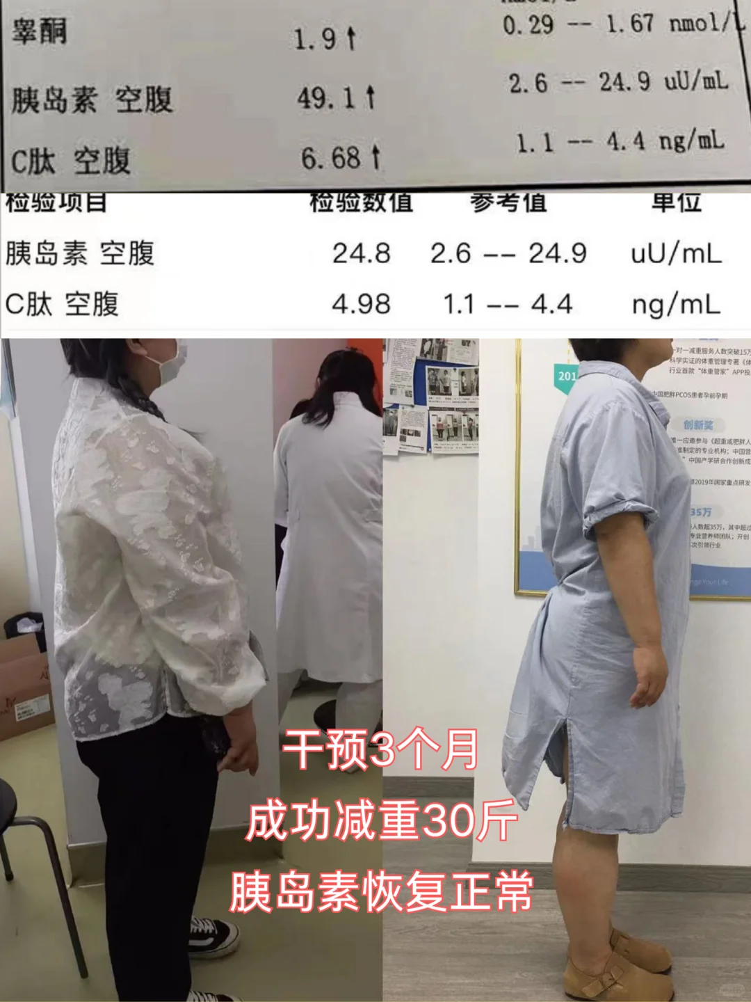 胰岛素抵抗，真的要好好做